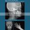 HC-D016 Iray Digital X ray machine price medical radiology equipment medical hospital high frequency x ray equipment