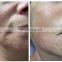 2021 Top sale 4D HIFU skin rejuvenation facial anti aging hifu 4d 5D 8d hifu face lift body slimming machine