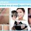 2016 hot sale CE approved Q-swiched nd yag laser with newest laser tips