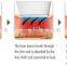 2015 New 808nm hair removal
