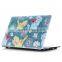 2016 hardshell laptop case for macbook pro 15 retina laptops