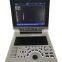 Ce Approved Portable Full Digital Medical Ultrasound Instruments for Hospital use