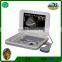 vet ultrasound with10.8" LED display 3D cheap professional animals use portable ultrasound 3018VL