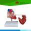 Direct factory supplied human heart disease model