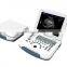 high quality notebook B/W  pregnancy diagnosis black and white ultrasound scanner