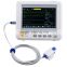 CE mark Hospital Handheld Mini 7 inch 6 parameter Patient Monitor RPM-9000F Capnography optional printer