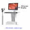 High definition digital electronic colposcope
