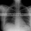 Medical X-ray DR Panel Detector
