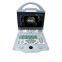 MY-A027A Medical Ultrasound equipment 2D Full digital color doppler system Portable ultrasound machine