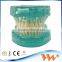 Popular Transparent Plastic Pathologic Dental Implant Model for study