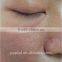 Spot Scar Pigment Removal Popipl Lady Laser Beauty Fractional Co2 Laser Equipment Scar Removal Professional