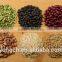 DCS-B Grain Intelligent Weighing and Packing Machines of Factory Suppliers With Double Hooper