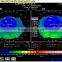 High-technology MCT Treatment of myopia and amblyopia