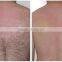  express hair salon equipment portable ipl/ipl laser permanent hair removal machine