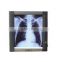Digital Medical film Dry X-ray thermal Film For Laser Printer china film dental film