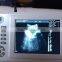 Full Digital Palm Ultrasound Scanner Handheld Veterinary Ultrasound Machine