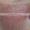 Vascular Treatment Fractional CO2 Laser Equipment Pigment Removal Redness Removal 10600nm CO2 Laser Device Acne Treatment Skin Regeneration