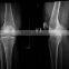 medical x-ray film /fuji printing clear image medical dry film with factory price
