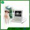Laptop VET Ultrasound Scanner/Machine KX5000