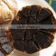 Professional black garlic from china for medical use