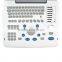 China Medical Ultrasonic Equipment pc based usb ultrasound scanner with cheap price