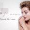 GSD Professional Fractional CO2 Laser Laser Tube 30W Medical Spa Equipment for Wart Removal, Scars Reduction