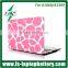 Hottest lovely pink shell case cover for Macbook Air 11/13" plastic protective case cover for Macbook Air/Pro 11" 13" 15"