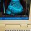 Notebook Type Black and White Ultrasound Scanner Medical Equipment