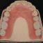 Removable Denture  Dental laboratory in china