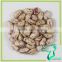 American Round Light Speckled Kidney Bean For Sale