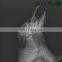 MY-W004A Newest Veterinary hospital equipment 200mA HF X-Ray Machine For Vet Use