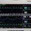 Promotional Low Price Medical Equipment 12 inch Multi-Parameter Patient Monitor with ETCO2 and Printer Recorder RPM-9000A-Shelly