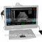 Sonostar 18" high resolution touch screen portable color doppler machine low price UTouch-8