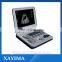 XF-30A Notebook full digital ultrasound scanner