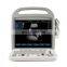 MY-A033 medical appliance 2D color doppler ultrasound scanner veterinary portable livestock ultrasound machine for animal