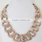 Hot Celebrity Women Fashion Jewelry Chunky Acrylic Thick Chain Necklace