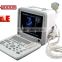 Sale portable Ultrasound Scanner with Convex probe for detecting gynecology obstetrics etc