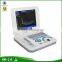 Portable Laptop ultrasound scanner with CE