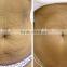 portable radio frequency fractional magic pot rf and microneedle rf wrinkle removal machine/ /home us