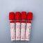 plain blood tube red top blood tube blood test tube