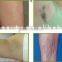 Manufacturer lasted product laser hair removal beauty machine 808nm