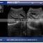 high quality notebook B/W  pregnancy diagnosis black and white ultrasound scanner