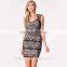 New Women Summer Casual Floral Sleeveless Sexy Party black lace dress, black lace dress, dress woman 2015