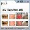 protable co2 fractional laser 2015/acne scar laser treatment/depil laser for hair removal