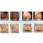 mini laser weight loss and fast fat removal machine for sale