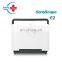 Multifunctional with new probe Ultrasound machine portable color doppler ultrasound system Sonoscape e2