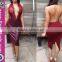 2016 Hot Sexy V-neck Party Girl Dress
