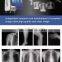 MY-D019F medical device china x-ray dr system machine digital portable x-ray unit