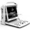 MCB-ECO3 color doppler portable ultrasound machines china portable ultrasound machine price