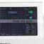100% high quality 8.4 inch Fetal monitor with TOCO/ultrasonic transducer fetal mark for pregnancy CE ISO approved